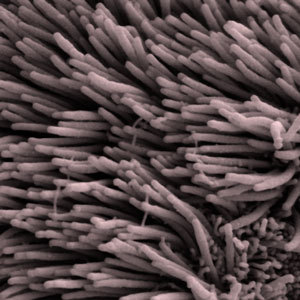 Les cils sont de minuscules poils, comme des saillies sur nos cellules. Différentes étiquettes conduisent la huntingtine à interagir avec les cils de façon différente.  