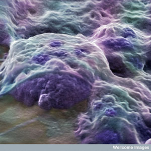 Ces cellules souches embryonnaires, qui proviennent d'un embryon humain, peuvent se transformer en n'importe quel type de cellule. Mais elles sont difficiles à obtenir et ne peuvent pas être utilisées pour traiter directement la MH.