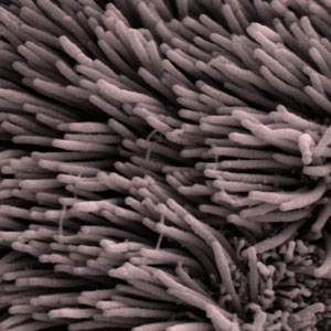 Les cils, ces minuscules "poils" qui tapissent les ventricules cérébraux, battent de façon synchronisée pour pomper le liquide céphalorachidien. Ce mécanisme est affecté dans la MH, mais il n'est pas encore clair si ceci est lié aux problèmes de "nettoyage de déchets" observés dans le cerveau atteint par la MH.