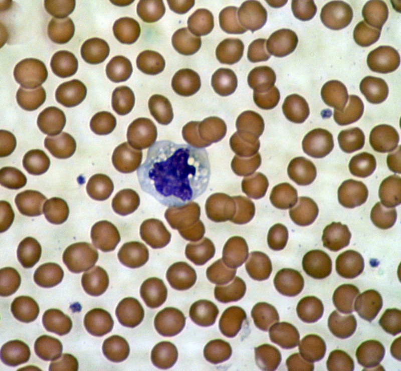 Une image microscopique des cellules sanguines - les globules rouges entourent une cellule du système immunitaire.