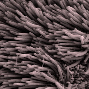 Les cils sont de minuscules poils, comme des saillies sur nos cellules. Différentes étiquettes conduisent la huntingtine à interagir avec les cils de façon différente.