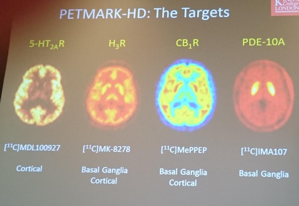 Marios Politis a annoncé son étude PETMARK-HD qui permettra de comparer plusieurs méthodes d'analyse moléculaire, pour la première fois dans le cadre de la MH