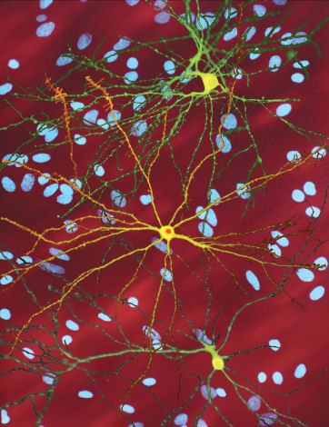 Culture de neurones - Finkbeiner lab. Les cellules vertes et jaunes ont été "marquées" et brillent, montrant la forme des cellules.  