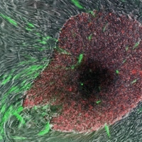'Cellules souches pluripotentes induites' en vert et rouge, se développant autour des cellules de la peau  
