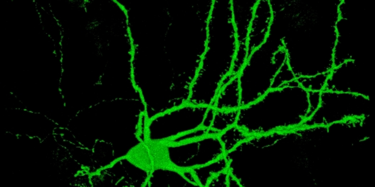 Transformation de cellules de peau en cellules du cerveau : une percée dans la recherche sur la maladie de Huntington ?