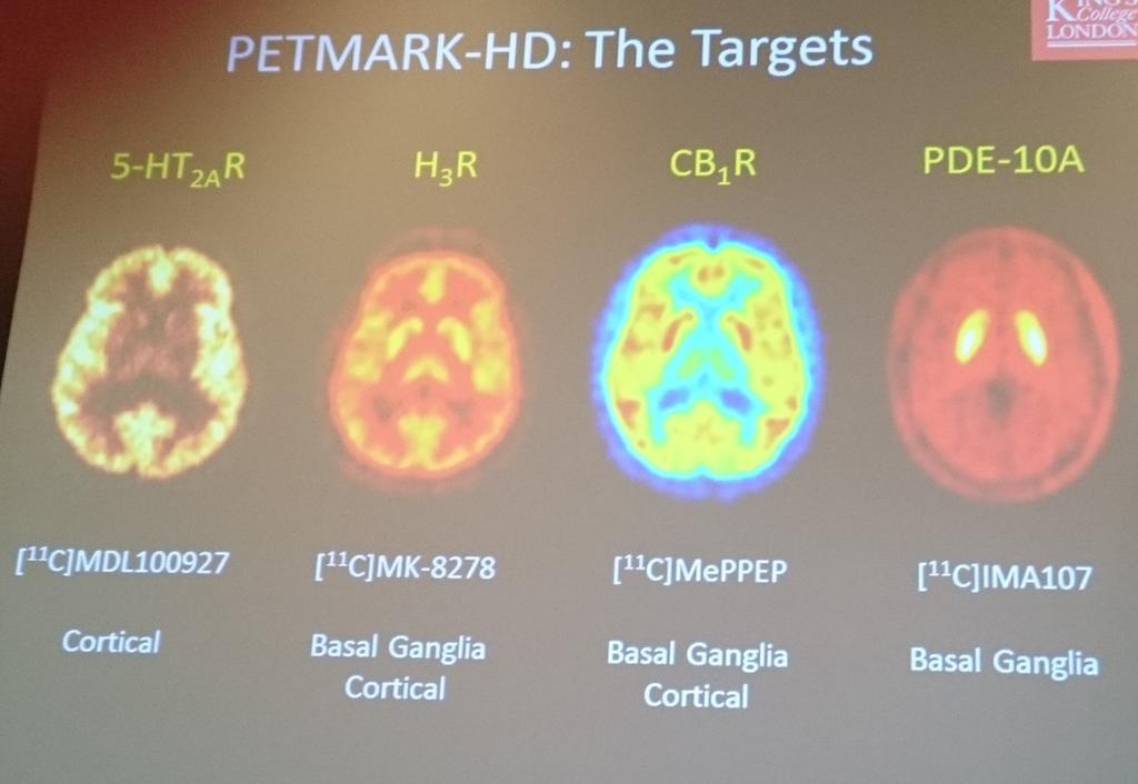 Marios Politis a annoncé son étude PETMARK-HD qui permettra de comparer plusieurs méthodes d'analyse moléculaire, pour la première fois dans le cadre de la MH  