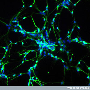Les cellules souches peuvent être utilisées pour faire pousser des neurones au laboratoire. Ces neurones sont des outils très puissants pour étudier des maladies comme la HD.  