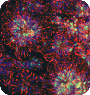 Les cellules souches neurales forment de bonnes connexions.